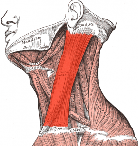 Torcicollo